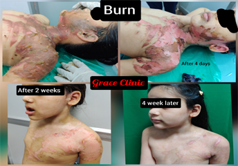 grace clinic dehradun