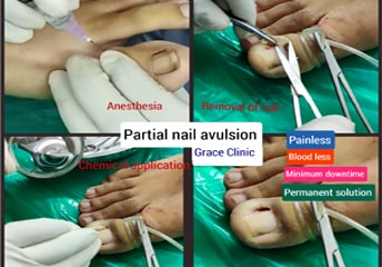 grace clinic dehradun