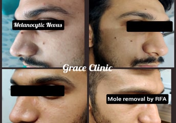 grace clinic dehradun
