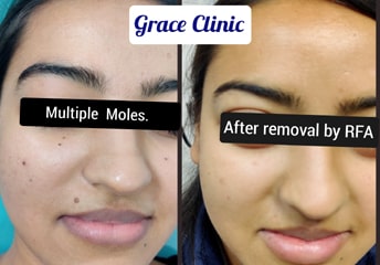 grace clinic dehradun