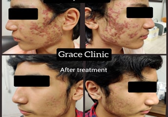 grace clinic dehradun