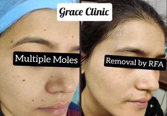 grace clinic dehradun