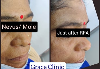 grace clinic dehradun