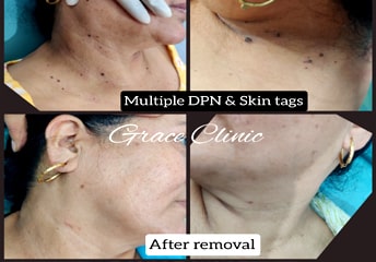 grace clinic dehradun