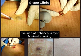 grace clinic dehradun