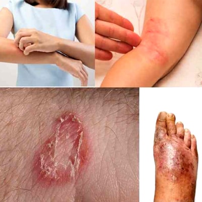 MISSING TEETH REPLACED WITH Skin Problems