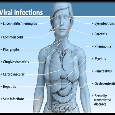 MISSING TEETH REPLACED WITH Skin Problems