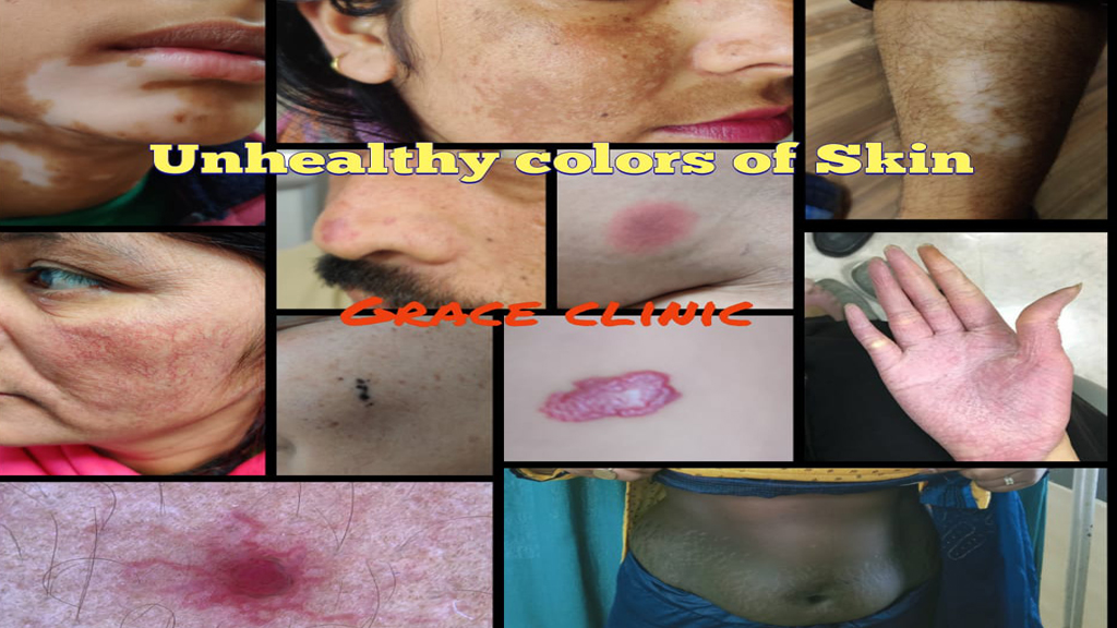unhealthy color